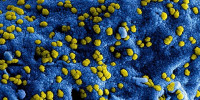 Coronavirus UPDATE 22 april